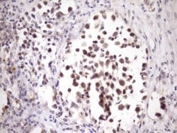 Invitrogen ZNF449 Monoclonal Antibody (OTI4C6) 100 &mu;L; Unconjugated:Antibodies,