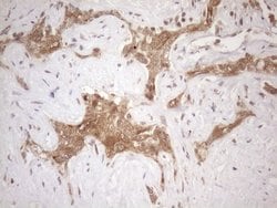 Invitrogen CHMP5 Monoclonal Antibody (OTI2E6) 100 &mu;L; Unconjugated:Antibodies,