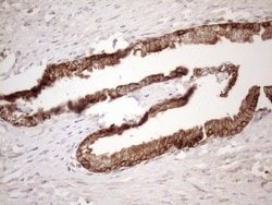 Invitrogen CHMP5 Monoclonal Antibody (OTI2E6) 100 &mu;L; Unconjugated:Antibodies,