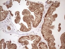 Invitrogen CHMP5 Monoclonal Antibody (OTI2E6) 100 &mu;L; Unconjugated:Antibodies,