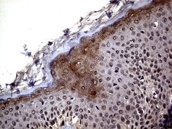 Invitrogen ERCC8 Monoclonal Antibody (OTI5C9) 100 &mu;L; Unconjugated:Antibodies,