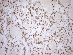 Invitrogen UTP11L Monoclonal Antibody (OTI5F3) 100 &mu;L; Unconjugated:Antibodies,