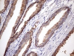 PHD1 Monoclonal Antibody (OTI7H3):Antibodies, Monoclonal