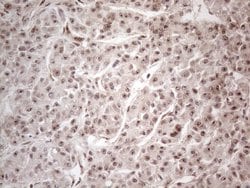 Invitrogen HMGB4 Monoclonal Antibody (OTI5G3) 100 &mu;L; Unconjugated:Antibodies,