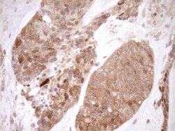 Invitrogen ITPK1 Monoclonal Antibody (OTI1F5) 100 &mu;L; Unconjugated:Antibodies,