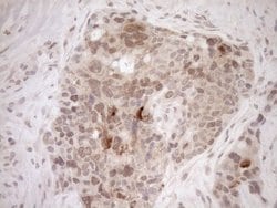 Invitrogen PARG Monoclonal Antibody (OTI6F4) 100 &mu;L; Unconjugated:Antibodies,