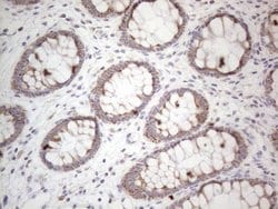 Invitrogen MRPL10 Monoclonal Antibody (OTI2B4) 100 &mu;L; Unconjugated:Antibodies,
