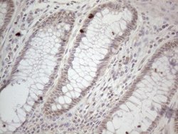 Invitrogen ZNF69 Monoclonal Antibody (OTI4A4) 100 &mu;L; Unconjugated:Antibodies,