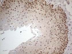 Invitrogen ZNF69 Monoclonal Antibody (OTI4A4) 100 &mu;L; Unconjugated:Antibodies,