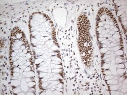 Invitrogen CWC27 Monoclonal Antibody (OTI4C8) 100 &mu;L; Unconjugated:Antibodies,