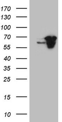 Invitrogen CWC27 Monoclonal Antibody (OTI4C8) 100 &mu;L; Unconjugated:Antibodies,