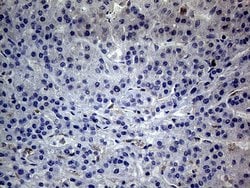 Invitrogen betatrophin Monoclonal Antibody (OTI5E2) 100 &mu;L; Unconjugated:Antibodies,