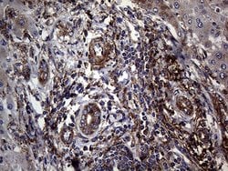 Invitrogen betatrophin Monoclonal Antibody (OTI5E2) 100 &mu;L; Unconjugated:Antibodies,