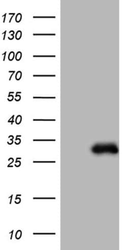 Invitrogen betatrophin Monoclonal Antibody (OTI5E2) 100 &mu;L; Unconjugated:Antibodies,