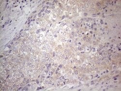 Invitrogen Gemin 2 Monoclonal Antibody (OTI4B3) 100 &mu;L; Unconjugated:Antibodies,