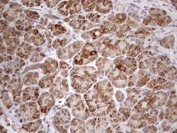 Invitrogen SHMT2 Monoclonal Antibody (OTI3E9) 100 &mu;L; Unconjugated:Antibodies,