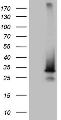 Invitrogen SNX10 Monoclonal Antibody (OTI6B7) 100 &mu;L | Buy Online | Invitrogen&trade; | Fisher Scientific