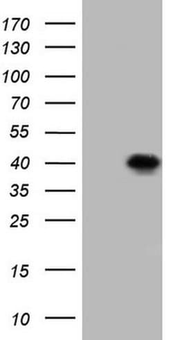 Invitrogen Bcl-G Monoclonal Antibody (OTI6D1) 100 &mu;L; Unconjugated:Antibodies,