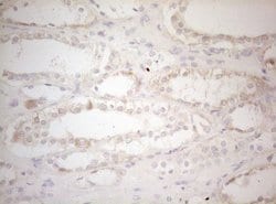Invitrogen MAD4 Monoclonal Antibody (OTI7F7) 100 &mu;L; Unconjugated:Antibodies,