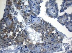 Invitrogen ZNF394 Monoclonal Antibody (OTI1G9) 100 &mu;L; Unconjugated:Antibodies,
