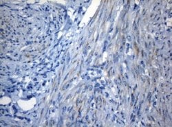 Invitrogen ZNF394 Monoclonal Antibody (OTI1G9) 100 &mu;L; Unconjugated:Antibodies,