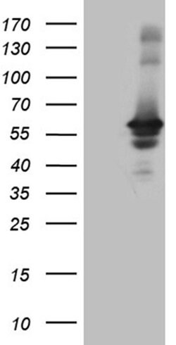 Invitrogen RAB3IP Monoclonal Antibody (OTI4A7) 100 &mu;L | Buy Online | Invitrogen&trade; | Fisher Scientific