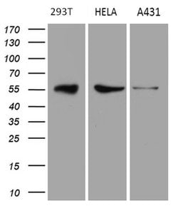 Invitrogen RAB3IP Monoclonal Antibody (OTI4A7) 100 &mu;L | Buy Online | Invitrogen&trade; | Fisher Scientific