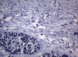 Invitrogen SAMD12 Monoclonal Antibody (OTI2G1) 100 &mu;L; Unconjugated:Antibodies,