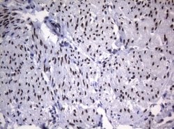 Invitrogen SAMD12 Monoclonal Antibody (OTI2G1) 100 &mu;L; Unconjugated:Antibodies,