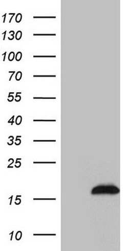 Invitrogen SAMD12 Monoclonal Antibody (OTI2G1) 100 &mu;L; Unconjugated:Antibodies,