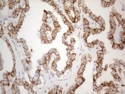 Invitrogen ZNF217 Monoclonal Antibody (OTI2B4) 100 &mu;L | Buy Online | Invitrogen&trade; | Fisher Scientific