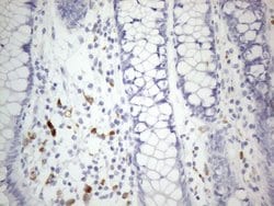 Invitrogen ZNF217 Monoclonal Antibody (OTI2B1) 100 &mu;L; Unconjugated:Antibodies,
