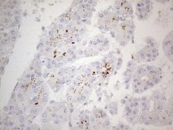 Invitrogen ZNF217 Monoclonal Antibody (OTI2B1) 100 &mu;L; Unconjugated:Antibodies,