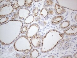 Invitrogen ZNF217 Monoclonal Antibody (OTI2B1) 100 &mu;L; Unconjugated:Antibodies,