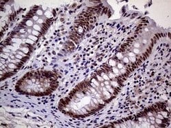 Invitrogen MAGEB4 Monoclonal Antibody (OTI3H2) 100 &mu;L; Unconjugated:Antibodies,