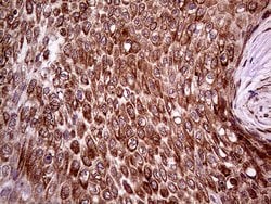 Invitrogen ERLIN1 Monoclonal Antibody (OTI4B1) 100 &mu;L | Buy Online | Invitrogen&trade; | Fisher Scientific