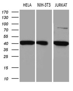 Invitrogen ELP4 Monoclonal Antibody (OTI4H10) 100 &mu;L; Unconjugated:Antibodies,