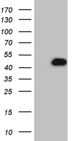 Invitrogen NDUFAF5 Monoclonal Antibody (OTI6A9) 100 &mu;L; Unconjugated:Antibodies,