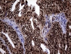 Invitrogen SSU72 Monoclonal Antibody (OTI5A1) 100 &mu;L; Unconjugated:Antibodies,