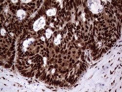 Invitrogen SSU72 Monoclonal Antibody (OTI2E2) 100 &mu;L; Unconjugated:Antibodies,