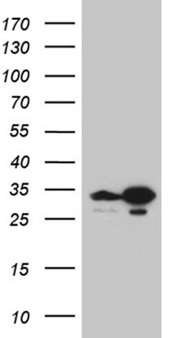 Invitrogen TSN Monoclonal Antibody (OTI4C6) 100 &mu;L | Buy Online | Invitrogen&trade; | Fisher Scientific