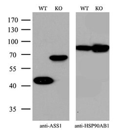 Invitrogen ASS1 Monoclonal Antibody (OTI12G1) 100 &mu;L | Buy Online | Invitrogen&trade; | Fisher Scientific