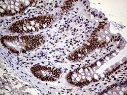 Invitrogen MAGEB4 Monoclonal Antibody (OTI3A3) 100 &mu;L; Unconjugated:Antibodies,