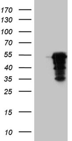 Invitrogen MAGEB4 Monoclonal Antibody (OTI1B5) 100 &mu;L | Buy Online | Invitrogen&trade; | Fisher Scientific