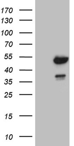 FCRLB Monoclonal Antibody (OTI4C4), Invitrogen 100 &mu;L; Unconjugated:Antibodies,