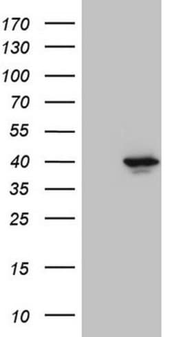 Invitrogen PITPNB Monoclonal Antibody (OTI6H10) 100 &mu;L; Unconjugated:Antibodies,