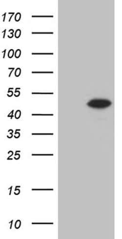 Invitrogen STX18 Monoclonal Antibody (OTI2C4) 100 &mu;L; Unconjugated:Antibodies,