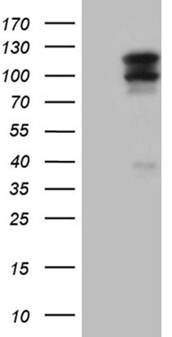 OTUD7B Monoclonal Antibody (OTI2E2):Antibodies, Monoclonal