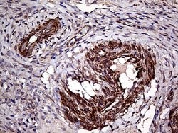 Invitrogen TRMT12 Monoclonal Antibody (OTI3C10) 100 &mu;L; Unconjugated:Antibodies,