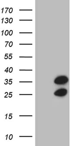 Invitrogen RPL10A Monoclonal Antibody (OTI2G9) 100 &mu;L; Unconjugated:Antibodies,